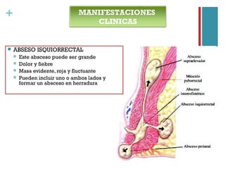 + MANIFESTACIONES
CLINICAS
 ABSESO ISQUIORRECTAL
 Este absceso puede ser grande
 Dolor y fiebre
 Masa evidente, roja y fluctuante
 Pueden incluir uno o ambos lados y
formar un absceso en herradura
 