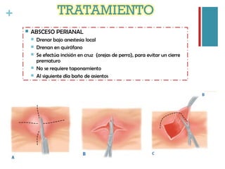 +
 ABSCESO PERIANAL
 Drenar bajo anestesia local
 Drenan en quirófano
 Se efectúa incisión en cruz (orejas de perro), para evitar un cierre
prematuro
 No se requiere taponamiento
 Al siguiente día baño de asientos
 