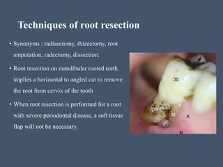 Fistulative and corrective surgery | PPTX
