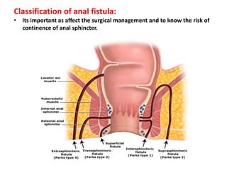 Classification of anal fistula:
• Its important as affect the surgical management and to know the risk of
continence of anal sphincter.
 