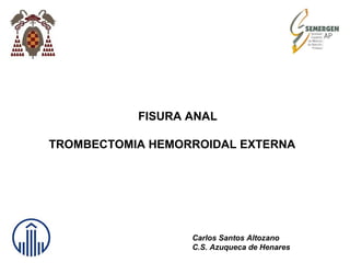 FISURA ANAL
TROMBECTOMIA HEMORROIDAL EXTERNA
Carlos Santos Altozano
C.S. Azuqueca de Henares
 