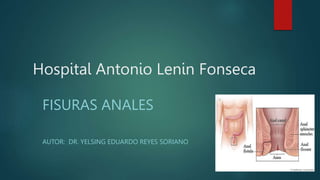 Hospital Antonio Lenin Fonseca
FISURAS ANALES
AUTOR: DR. YELSING EDUARDO REYES SORIANO
 