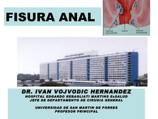 FISURA ANAL DR. IVAN VOJVODIC HERNANDEZ HOSPITAL EDGARDO REBAGLIATI MARTINS EsSALUD JEFE DE DEPARTAMENTO DE CIRUGIA GENERAL UNIVERSIDAD DE SAN MARTIN DE PORRES PROFESOR PRINCIPAL 