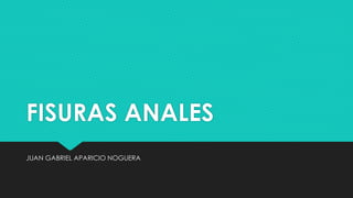 FISURAS ANALES
JUAN GABRIEL APARICIO NOGUERA
 