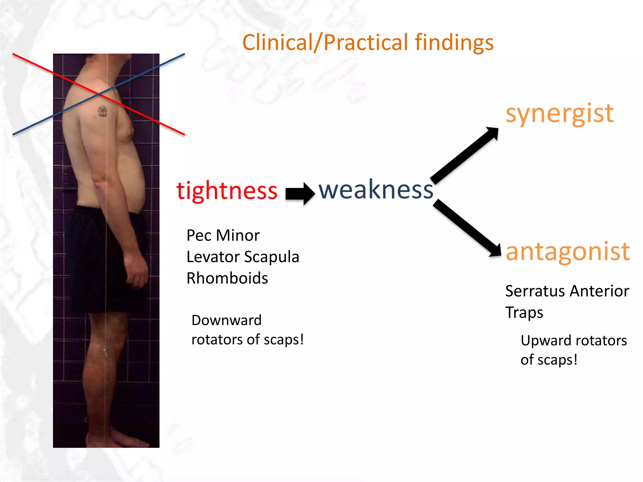 Clinical/Practical findings

                                       synergist

tightness             weakness
Pec Minor
Levator Scapula                        antagonist
Rhomboids
                                       Serratus Anterior
 Downward                              Traps
 rotators of scaps!                      Upward rotators
                                         of scaps!
 