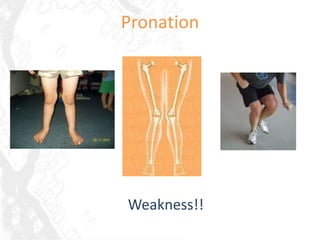 Pronation




Weakness!!
 
