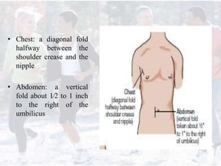 • Chest: a diagonal fold
halfway between the
shoulder crease and the
nipple
• Abdomen: a vertical
fold about 1⁄2 to 1 inch
to the right of the
umbilicus
 