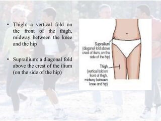• Thigh: a vertical fold on
the front of the thigh,
midway between the knee
and the hip
• Suprailium: a diagonal fold
above the crest of the ilium
(on the side of the hip)
 