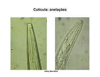 Cutícula: anelações
Kathy Merrifield
 