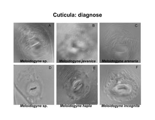 Cutícula: diagnose
Meloidogyne sp. Meloidogyne arenaria
Meloidogyne incognita
Meloidogyne javanica
Meloidogyne sp. Meloidogyne hapla
 