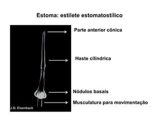 Estoma: estilete estomatostílico
J.D. Eisenback
Parte anterior cônica
Haste cilíndrica
Nódulos basais
Musculatura para movimentação
 