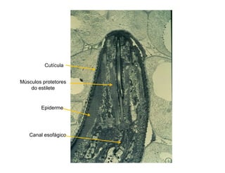 Músculos protetores
do estilete
Epiderme
Cutícula
Canal esofágico
 