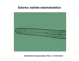 Estoma: estilete estomatostílico
Belanolaimus longicaudatus. Foto: J. D. Eisenback
 