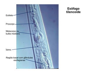 Estilete
Metacorpo ou
bulbo mediano
Região basal com glândulas
esofagianas
Ístmo
Procorpo
Esôfago
tilencoide
 