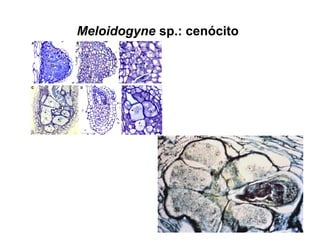 Meloidogyne sp.: cenócito
 
