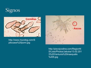 http://www.mycolog.com/S
pilocaea%20pomi.jpg
http://pisvojvodina.com/RegionN
S/Lists/Photos/Jabuka/13.02.201
3%20Venturia%20inaequalis
%205.jpg
Conidias
Ascos
 