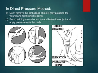 In Direct Pressure Method:
a) Don’t remove the embedded object it may plugging the
wound and restricting bleeding.
b) Pace padding around or above and below the object and
apply pressure over the pads.
 