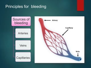 Principles for bleeding
Sources of
bleeding
Arteries
Veins
Capillaries
 