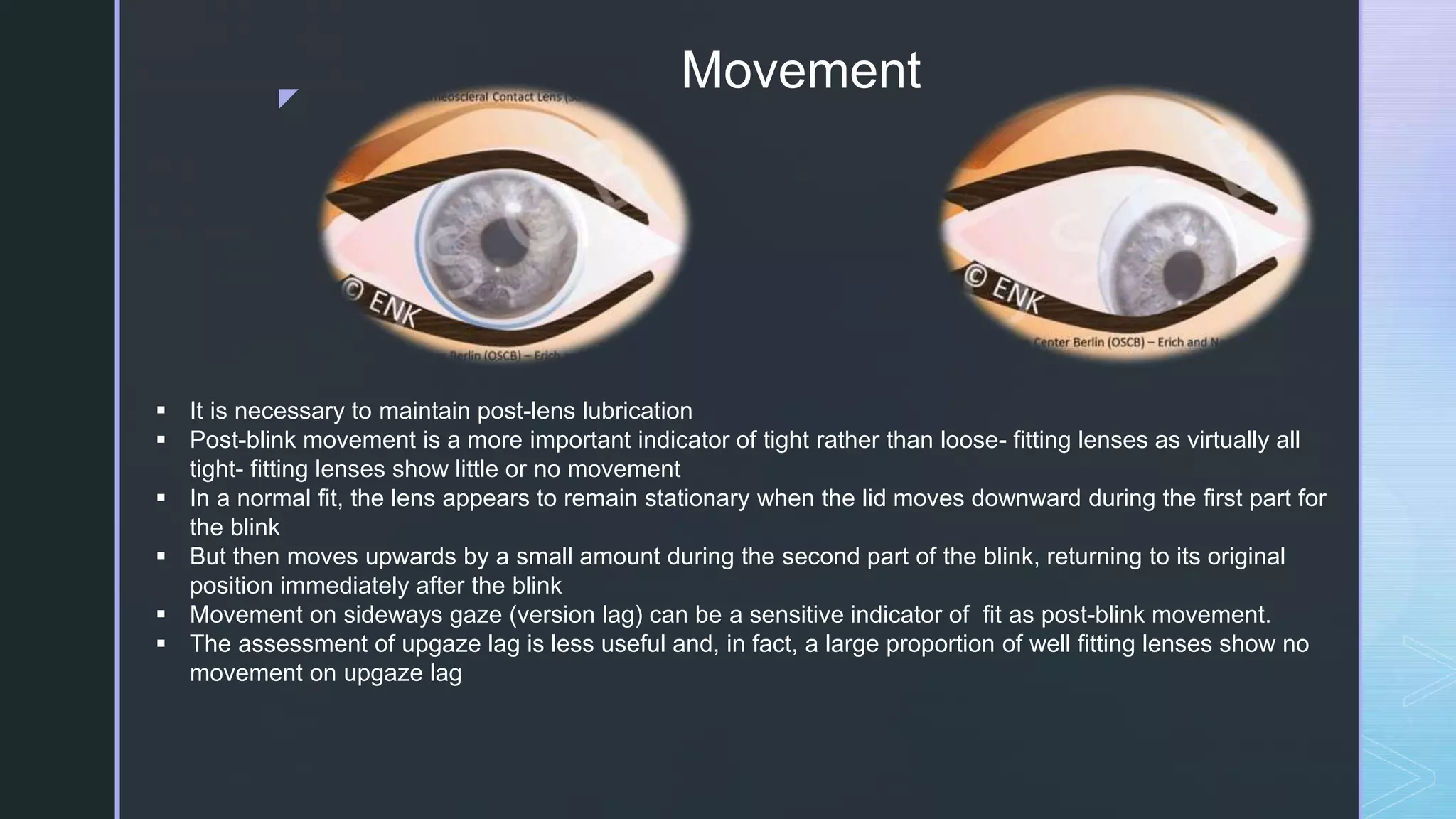 z
Movement
 It is necessary to maintain post-lens lubrication
 Post-blink movement is a more important indicator of tight rather than loose- fitting lenses as virtually all
tight- fitting lenses show little or no movement
 In a normal fit, the lens appears to remain stationary when the lid moves downward during the first part for
the blink
 But then moves upwards by a small amount during the second part of the blink, returning to its original
position immediately after the blink
 Movement on sideways gaze (version lag) can be a sensitive indicator of fit as post-blink movement.
 The assessment of upgaze lag is less useful and, in fact, a large proportion of well fitting lenses show no
movement on upgaze lag
 