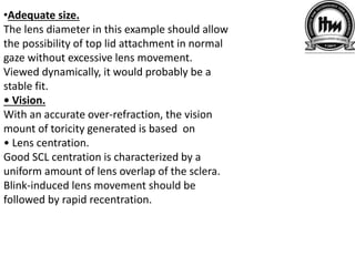 •Adequate size.
The lens diameter in this example should allow
the possibility of top lid attachment in normal
gaze without excessive lens movement.
Viewed dynamically, it would probably be a
stable fit.
• Vision.
With an accurate over-refraction, the vision
mount of toricity generated is based on
• Lens centration.
Good SCL centration is characterized by a
uniform amount of lens overlap of the sclera.
Blink-induced lens movement should be
followed by rapid recentration.
 
