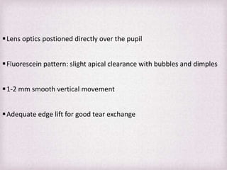 Fitting Philosophies and Assessment of Spherical RGP lenses | PPTX