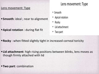 Piggyback Rgp Fitting Philosophies and Assessment of Spherical RGP lenses | PPTX