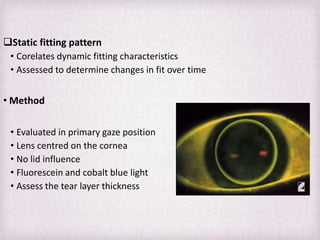 Toroidal Rgp Fitting Pattern Fitting Philosophies and Assessment of Spherical RGP lenses | PPTX