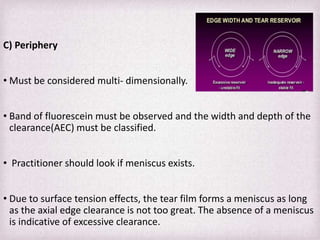 Edge Clearance Rgp Fitting Philosophies and Assessment of Spherical RGP lenses | PPTX