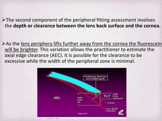 Edge Clearance Rgp Fitting Philosophies and Assessment of Spherical RGP lenses | PPTX
