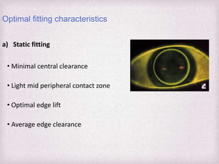Fitting Philosophies and Assessment of Spherical RGP lenses | PPTX