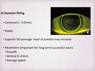 Fitting Philosophies and Assessment of Spherical RGP lenses | PPTX