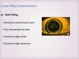 Fitting Philosophies and Assessment of Spherical RGP lenses | PPTX