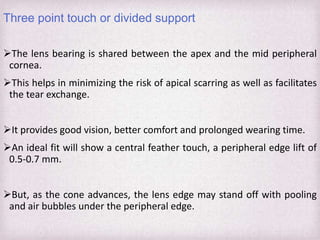 Tear Pooling Rgp Fitting Philosophies and Assessment of Spherical RGP lenses | PPTX