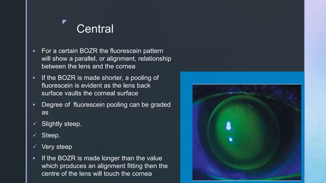 FITTING SPHERICAL RIGID GAS PERMEABLE CONTACT LENS | PPTX