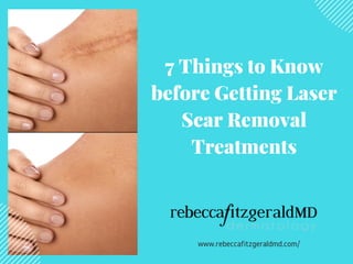 7 Things to Know
before Getting Laser
Scar Removal
Treatments
www.rebeccafitzgeraldmd.com/
 