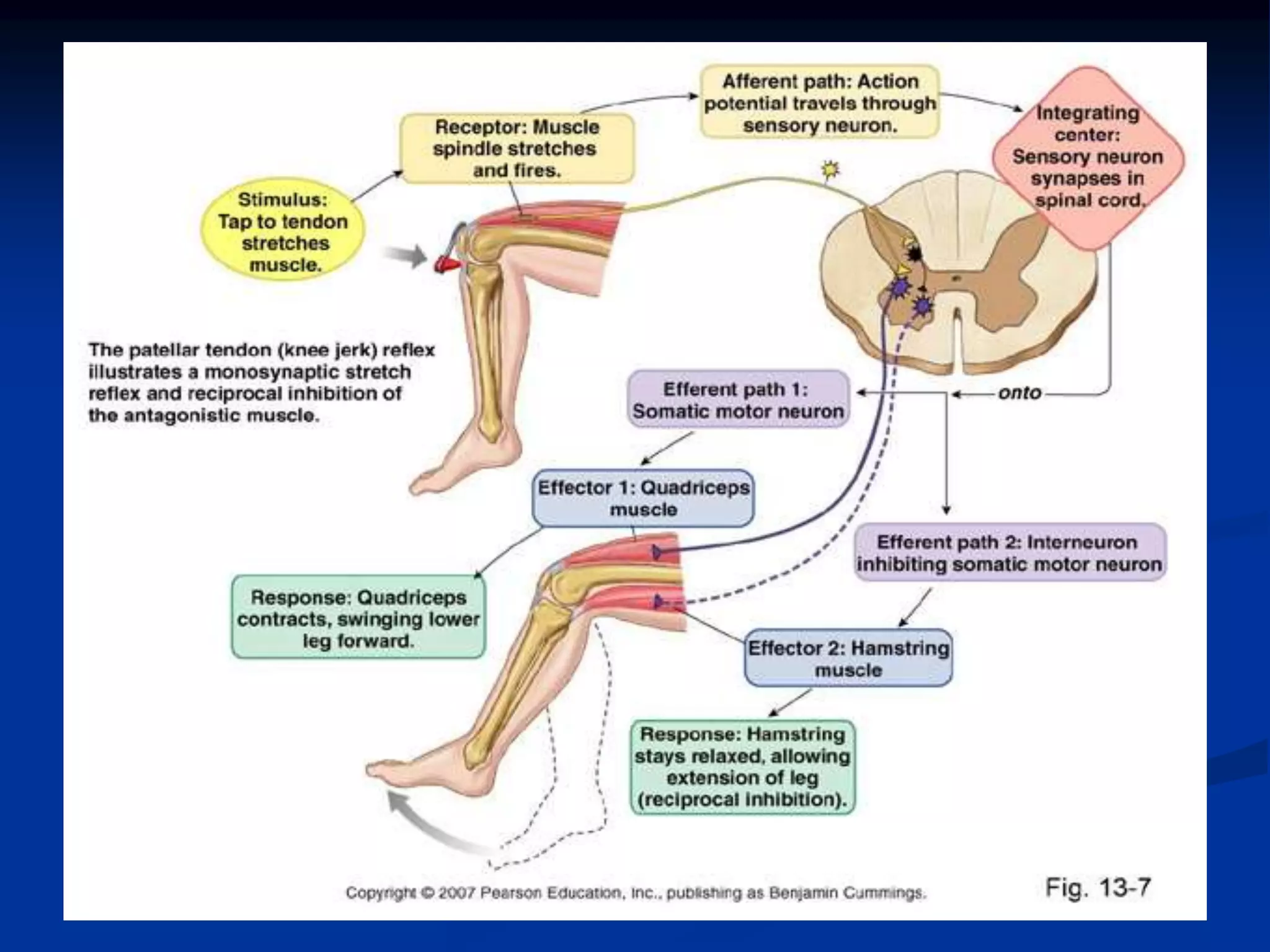 _FIU - Thoracic and Lumbar Spine Special Tests and Pathologies (1 ...