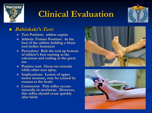 _FIU - Thoracic and Lumbar Spine Special Tests and Pathologies (1 ...