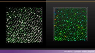 Fluorescence in vivo Endomicroscopy: Imaging and Analysis (Co-Hosted w ...