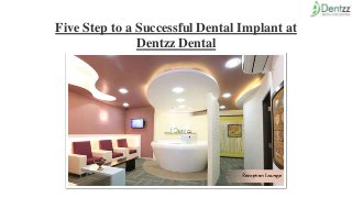 Five Step to a Successful Dental Implant at
Dentzz Dental
 