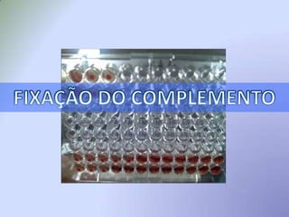  Complexo de ataque a membrana: Ao unir-se à membrana microbiana ou ao complexo Ac-Ag, o complemento forma um canal transmembrânico de forma anelar, causando uma lise osmótica, induzindo apoptose e, conseqüentemente, a morte da célula.Complexo de ataque à membranaInfluxo de fluidosBicamada fosfolipídicaCitoplasma