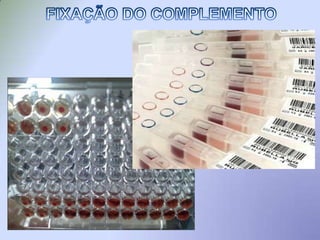  Sistema hemolítico (hemácias recobertas com antígenos)