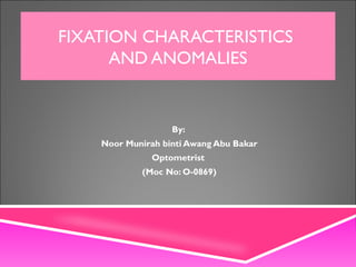 FIXATION CHARACTERISTICS
AND ANOMALIES
By:
Noor Munirah binti Awang Abu Bakar
Optometrist
(Moc No: O-0869)
 