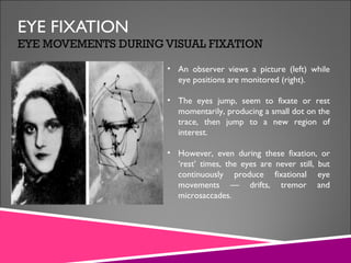 Visual Fixation Deficit Fixation characteristics and abnormalities | PPT
