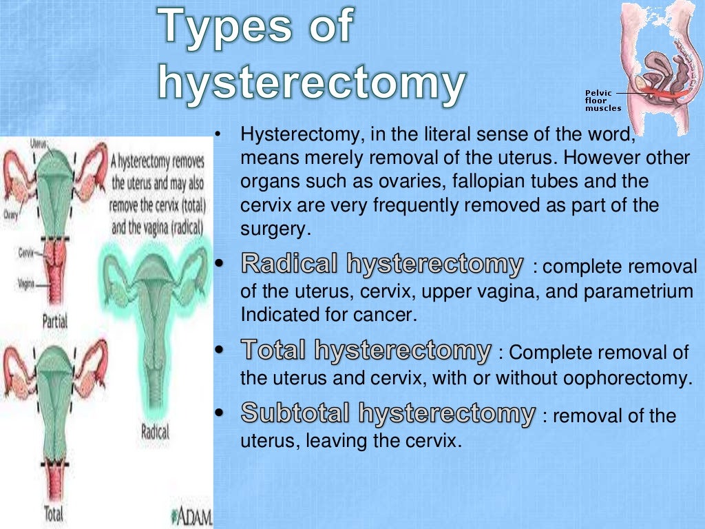 Fixation of uterus after whole hysterectomy