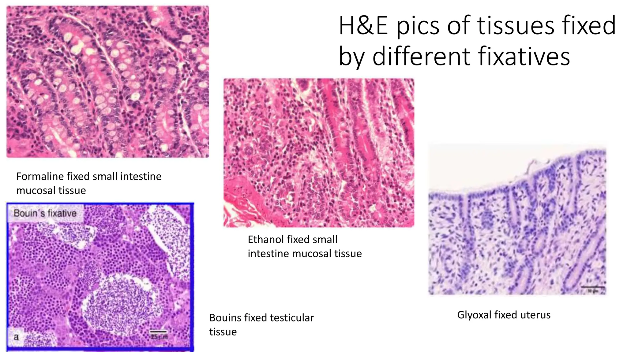 H&E pics of tissues fixed
by different fixatives
Formaline fixed small intestine
mucosal tissue
Ethanol fixed small
intestine mucosal tissue
Bouins fixed testicular
tissue
Glyoxal fixed uterus
 