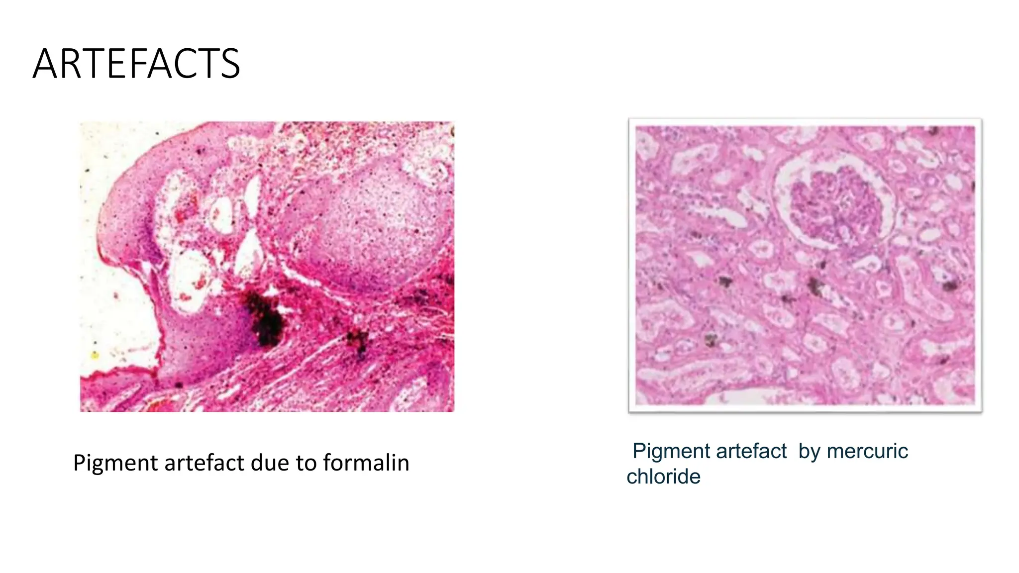 ARTEFACTS
Pigment artefact by mercuric
chloride
Pigment artefact due to formalin
 