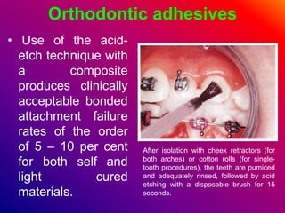Orthodontic adhesives
• Use of the acid-
etch technique with
a composite
produces clinically
acceptable bonded
attachment failure
rates of the order
of 5 – 10 per cent
for both self and
light cured
materials.
After isolation with cheek retractors (for
both arches) or cotton rolls (for single-
tooth procedures), the teeth are pumiced
and adequately rinsed, followed by acid
etching with a disposable brush for 15
seconds.
 