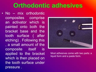 Orthodontic adhesives
• No – mix orthodontic
composites comprise
an activator which is
painted onto both the
bracket base and the
tooth surface ( after
etching) . Following this
, a small amount of the
composite itself is
applied to the bracket
which is then placed on
the tooth surface under
pressure .
Most adhesives come with two parts: a
liquid form and a paste form.
 