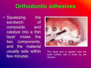 Orthodontic adhesives
• Squeezing the
sandwich of
composite and
catalyst into a thin
layer mixes the
two components,
and the material
usually sets within
few minutes .
The liquid part is applied onto the
tooth surface with a brush by the
clinician.
 