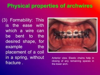 Physical properties of archwires
(3) Formability: This
is the ease with
which a wire can
be bent to the
desired shape, for
example the
placement of a coil
in a spring, without
fracture .
Anterior view. Elastic chains help in
closing of any remaining spaces in
the lower arch.
 